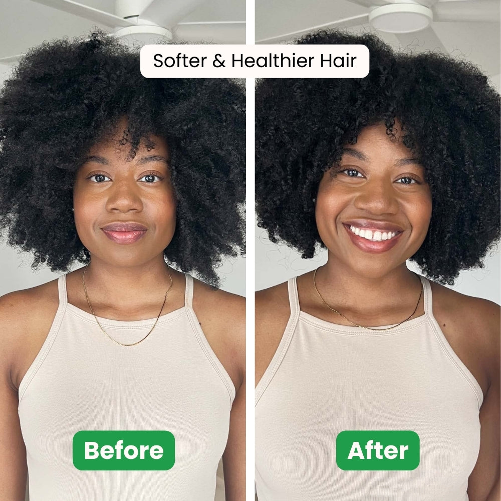Mistiva™ Moringa Hair Growth Capsules