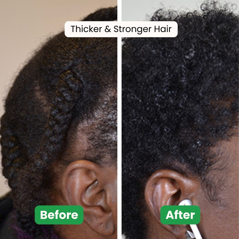 Mistiva™ Moringa Hair Growth Capsules